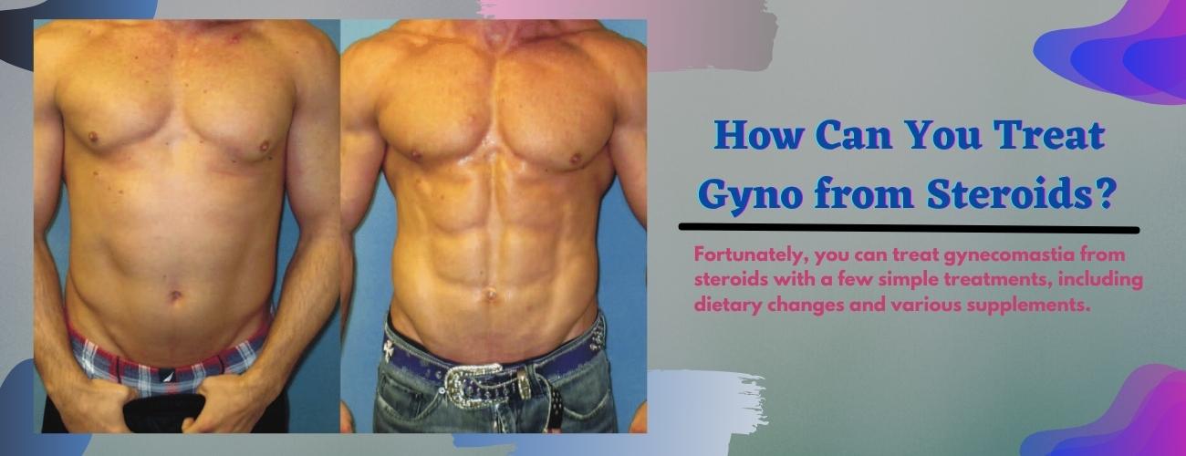 How Can You Treat Gyno from Stéroïdes?